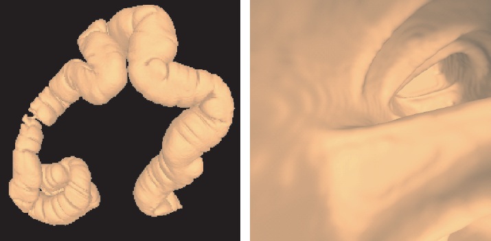 バーチャル内視鏡における視点操作のガイドシステム