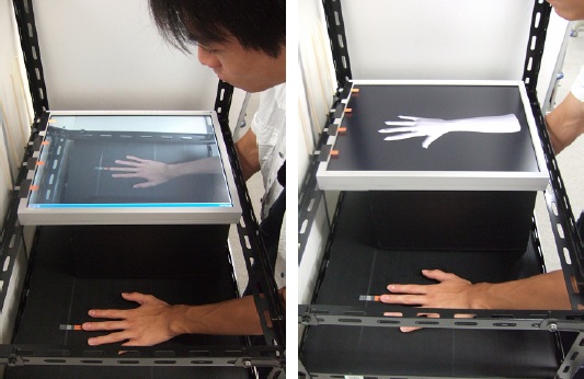 VRを用いた幻肢リハビリテーション